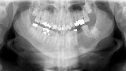 65b8218a947cfe001e072691 Case18 65b8218a947cfe001e072691 Case18