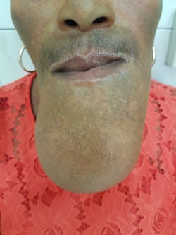 dental-pathology dental-pathology