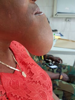 dental-pathology dental-pathology