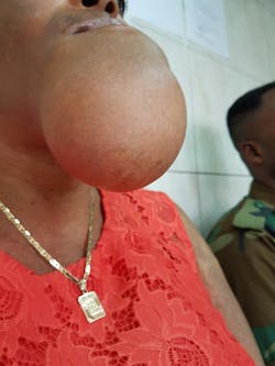 dental-pathology dental-pathology