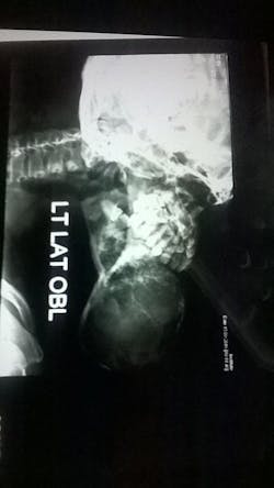 dental-pathology dental-pathology