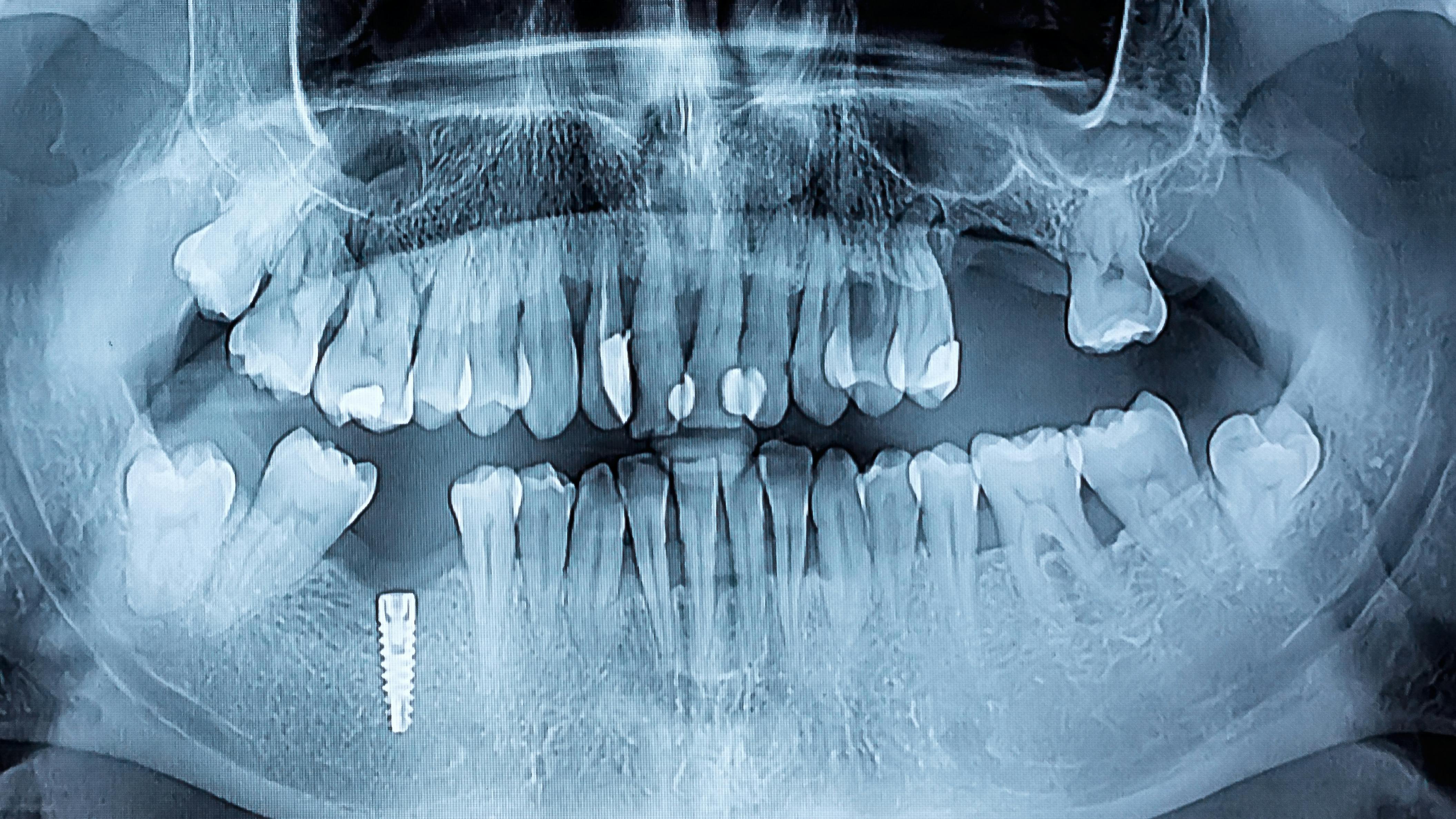 65f861bee686c6001f35e4b3 Dreamstime Xxl 66009906