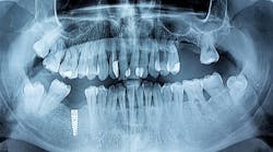 periodontal-disease periodontal-disease