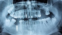 65f861bee686c6001f35e4b3 Dreamstime Xxl 66009906 65f861bee686c6001f35e4b3 Dreamstime Xxl 66009906