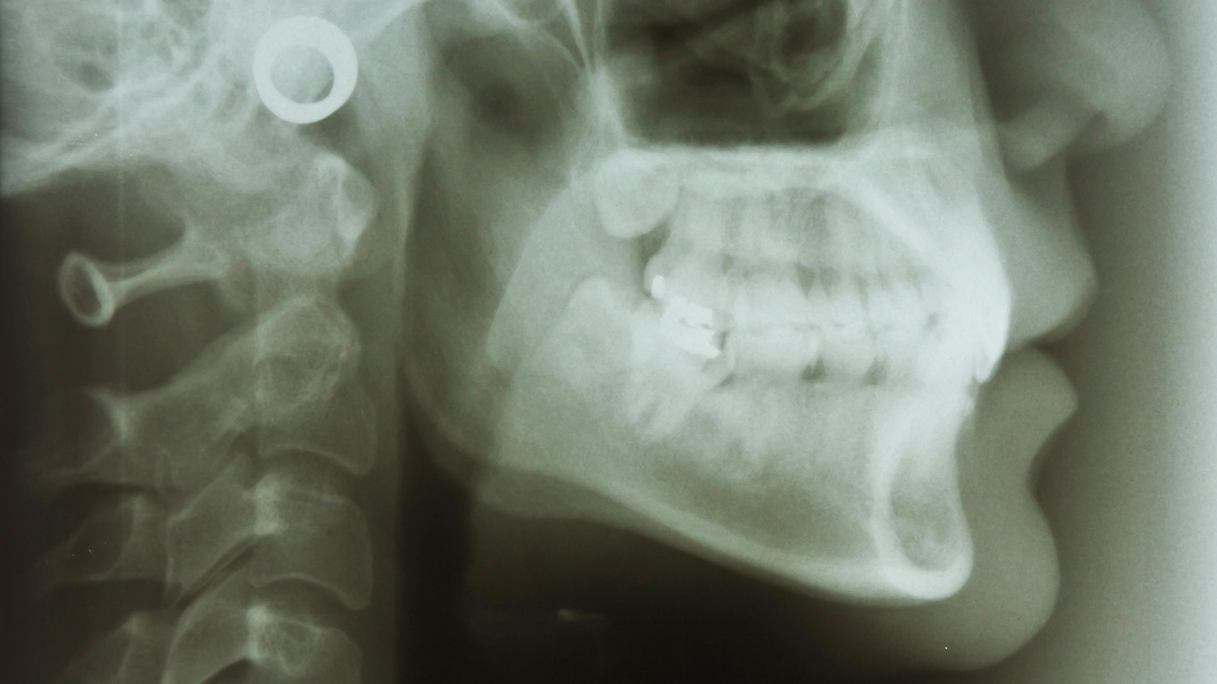 oral-systemic-health