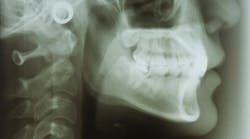 oral-systemic-health oral-systemic-health
