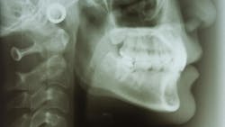 66197e1701972a001e5863a8 Dreamstime Xxl 17219195 66197e1701972a001e5863a8 Dreamstime Xxl 17219195