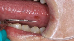 oral-pathology