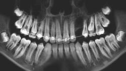 663d34833275e79493c9116f Oralpathology 663d34833275e79493c9116f Oralpathology