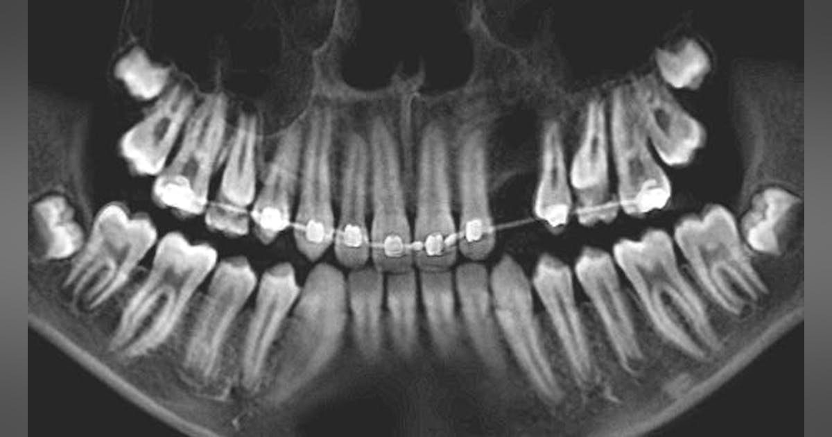 Oral pathology reference: Cases 1–6 | Dentistry IQ