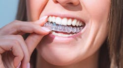 Person wearing dental aligners Person wearing dental aligners