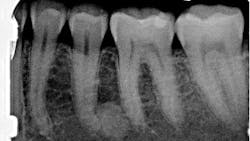 Pathology case: Differentials that may cross over Pathology case: Differentials that may cross over