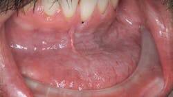 pathology of a chronic tobacco user pathology of a chronic tobacco user