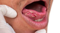 oral pathology oral pathology