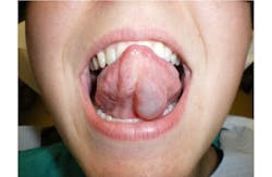 oral pathology reference oral pathology reference