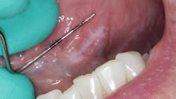 oral pathology reference oral pathology reference