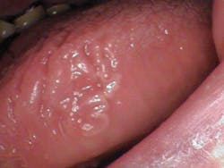 oral pathology oral pathology