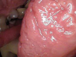 oral pathology oral pathology