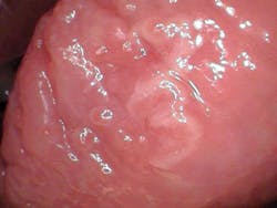 oral pathology oral pathology