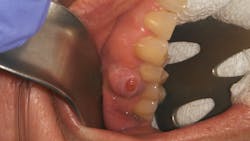 oral pathology oral pathology