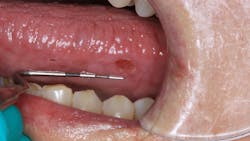 oral pathology oral pathology