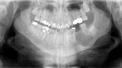 oral pathology oral pathology