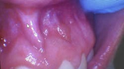 oral pathology oral pathology