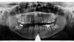 case19 case19