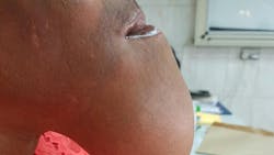 6707f58665119abfae408fa5 Case20 6707f58665119abfae408fa5 Case20