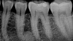 case21 case21