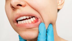 670e8f5fc6e2484dd2d8ed49 Gettyimages1377943103 670e8f5fc6e2484dd2d8ed49 Gettyimages1377943103