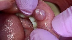 oral pathology oral pathology