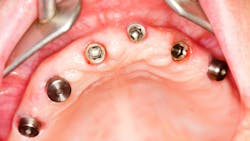 672a69f6e47b345a1ede9735 Dreamstime L 18145642 672a69f6e47b345a1ede9735 Dreamstime L 18145642