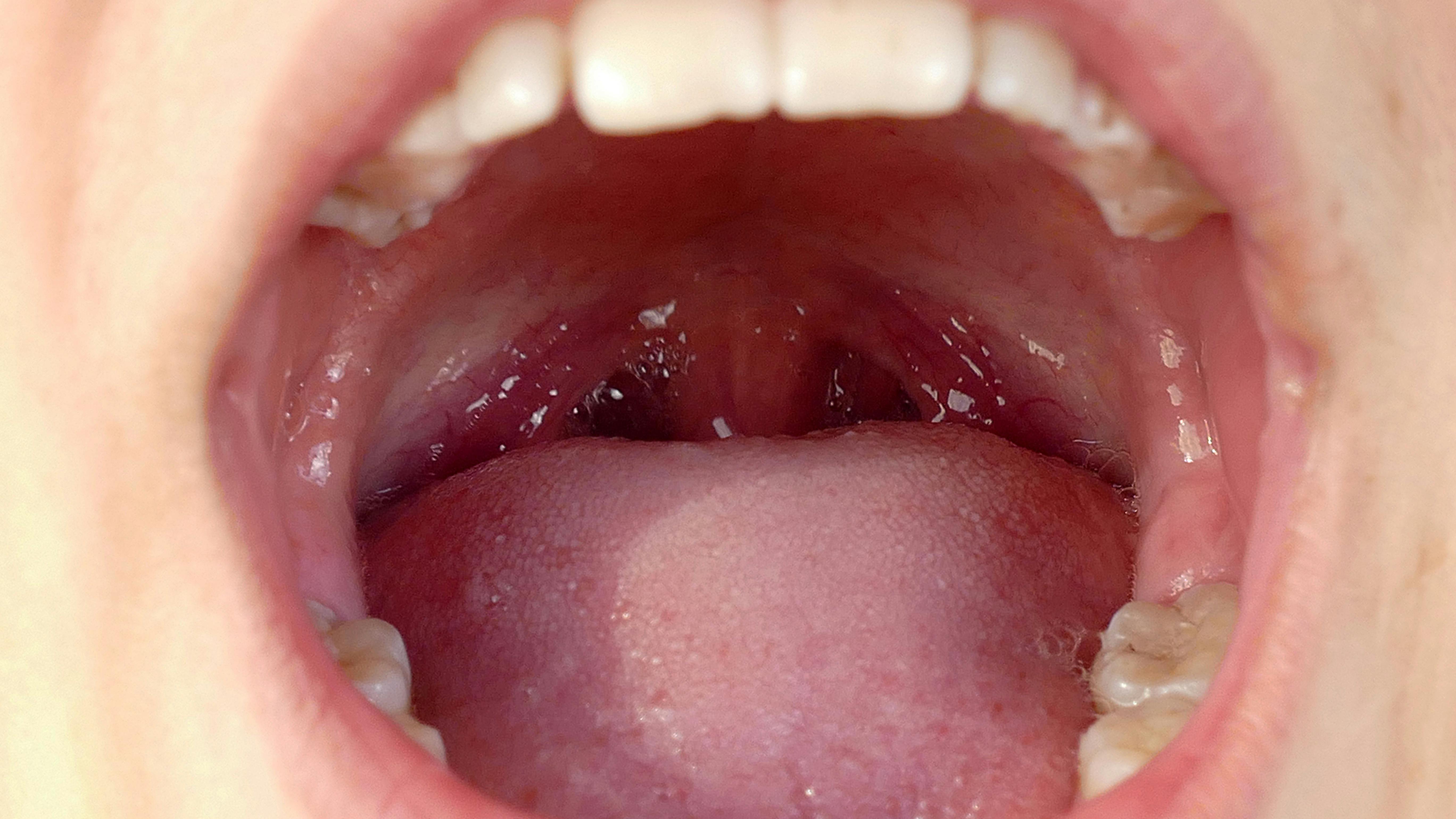 673b7f0c8e03063bbb195bf1 Gettyimages992047916