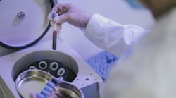 Platelet-rich fibrin (PRF) in dental surgery Platelet-rich fibrin (PRF) in dental surgery