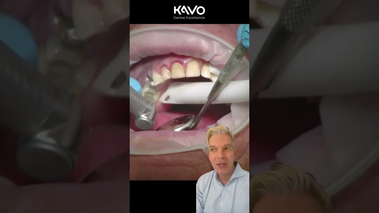 Slow speeds: Electric or air driven for you?