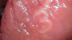 oral pathology oral pathology