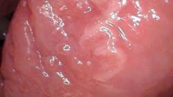 oral pathology oral pathology