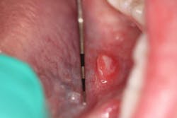 oral pathology oral pathology