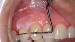 oral pathology
