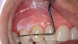 oral pathology oral pathology