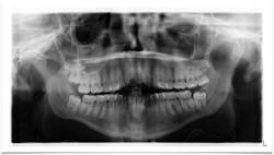 oral pathology oral pathology