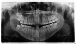 oral pathology oral pathology