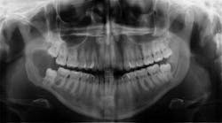 oral pathology oral pathology
