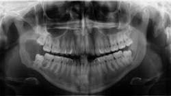 oral pathology oral pathology