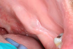 oral pathology oral pathology