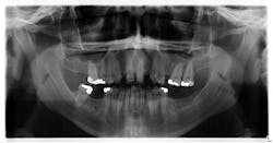 oral pathology oral pathology
