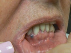 oral pathology oral pathology