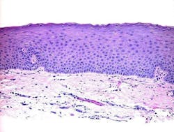 oral pathology oral pathology
