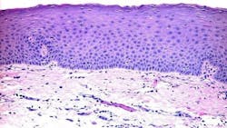 oral pathology oral pathology